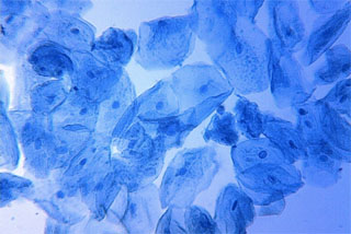 Human cheek cells