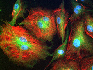 Bovine pulmonary artery endothelial cells