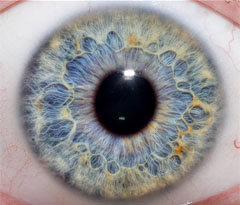 Eye