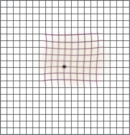 Amsler grid